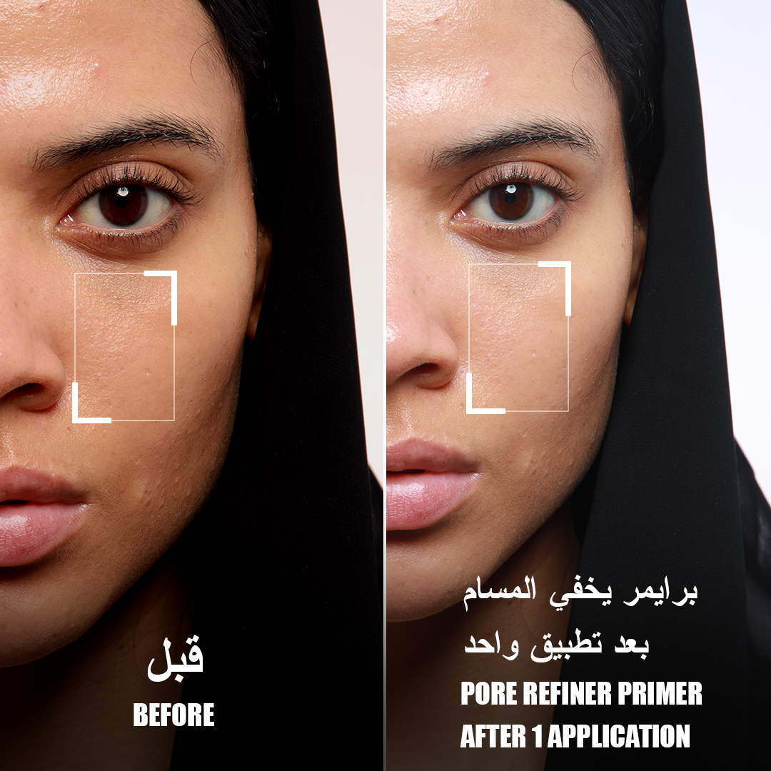 Forever52 Layered Pore Refine